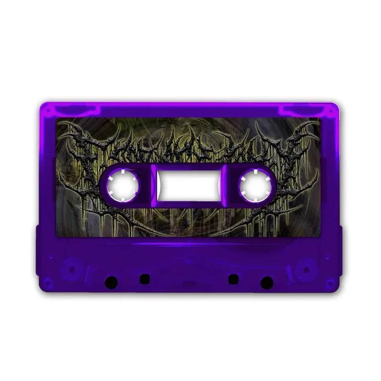 Esophagectomy - A Noxious Culmination Of Tools For Auditory Extermination cassette